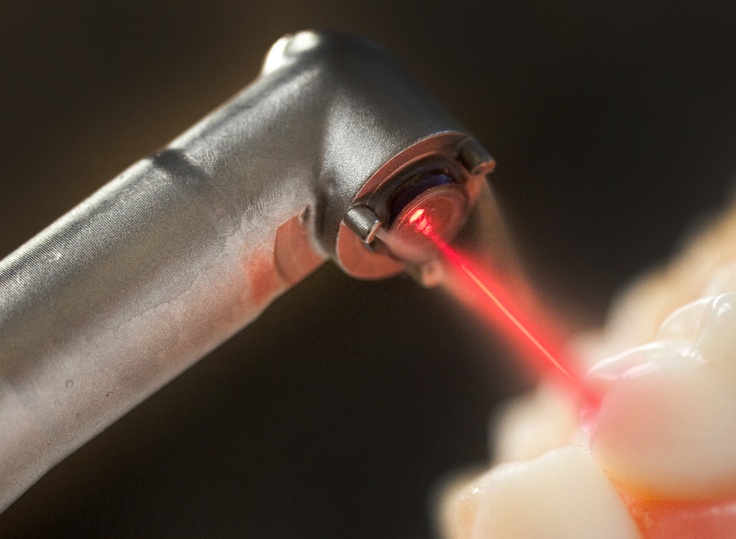 lightwalker erbium yag laser for hard tissue dentistry